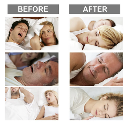 Before and after use of mouthpiece, wish you enjoy your good sleep