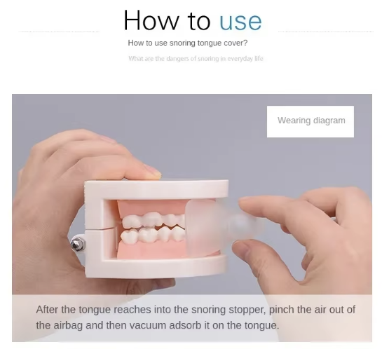 To prevent fall of tongue to oral cavity causing obstructive apnea